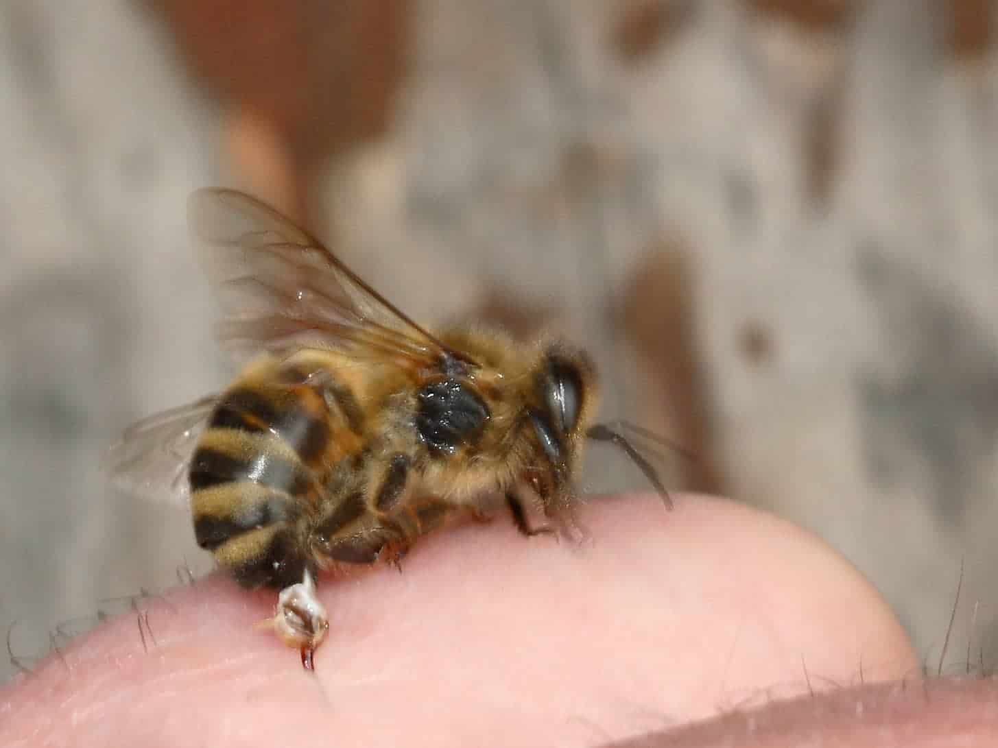 Stinger
